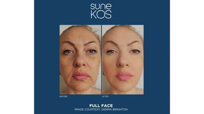 Sunekos Performa (2 x 3.5ml Vials)