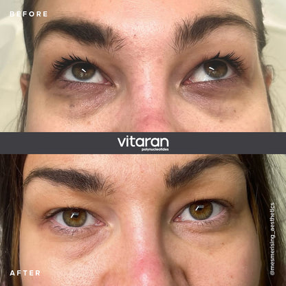 Vitaran I (2 x 1ml) UK