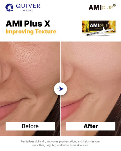 Ami Plus X