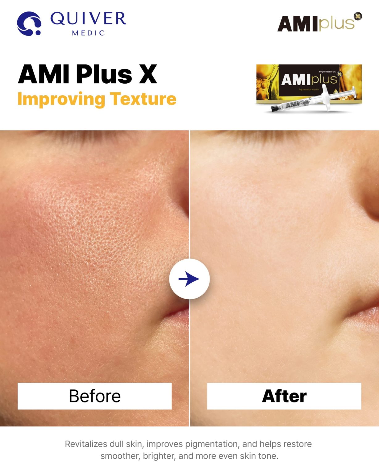 Ami Plus X