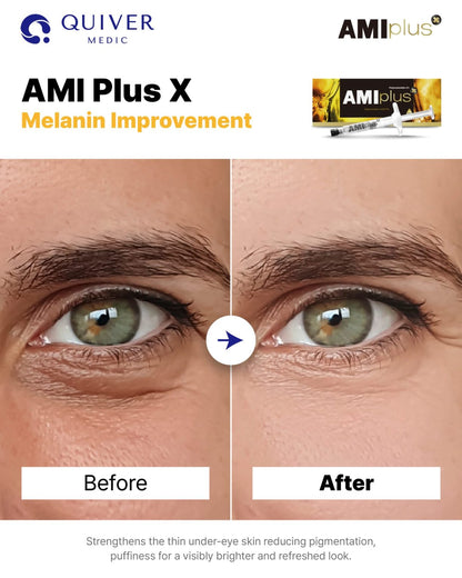 Ami Plus X