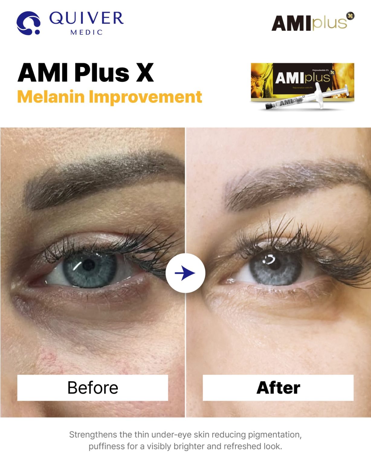 Ami Plus X