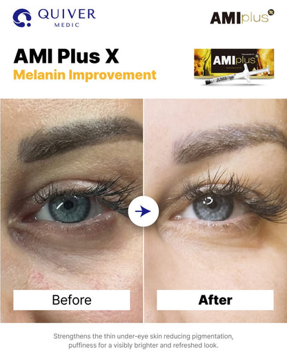 Ami Plus X
