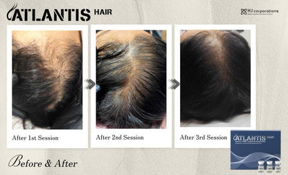 Atlantis Hair (exosomes) 5ml x 10 vials