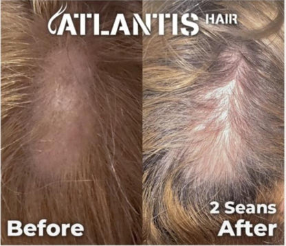 Atlantis Hair (exosomes) 5ml x 10 vials