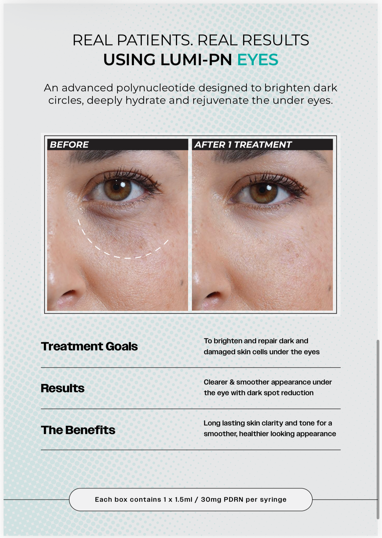 LUMI-PN EYES | 1×1.5ml per pack | Polynucleotide (PDRN) 30mg