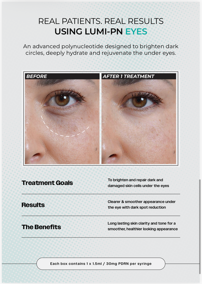 LUMI-PN EYES | 1×1.5ml per pack | Polynucleotide (PDRN) 30mg