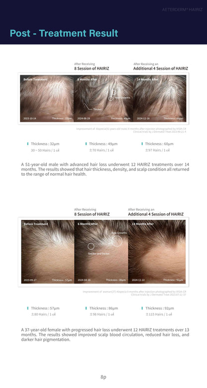 HAIRIZ 3D Exo Hair Scalp Care Filler
